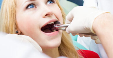 Quando é necessário remover os dentes do siso? 8